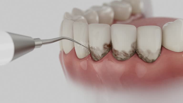 Reliable Dental contractor in St. Henry, OH by Dentist Open Now